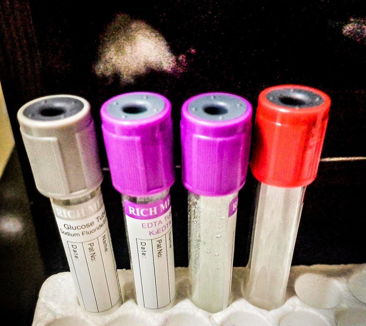 Test tubes in a rack in a medical laboratory